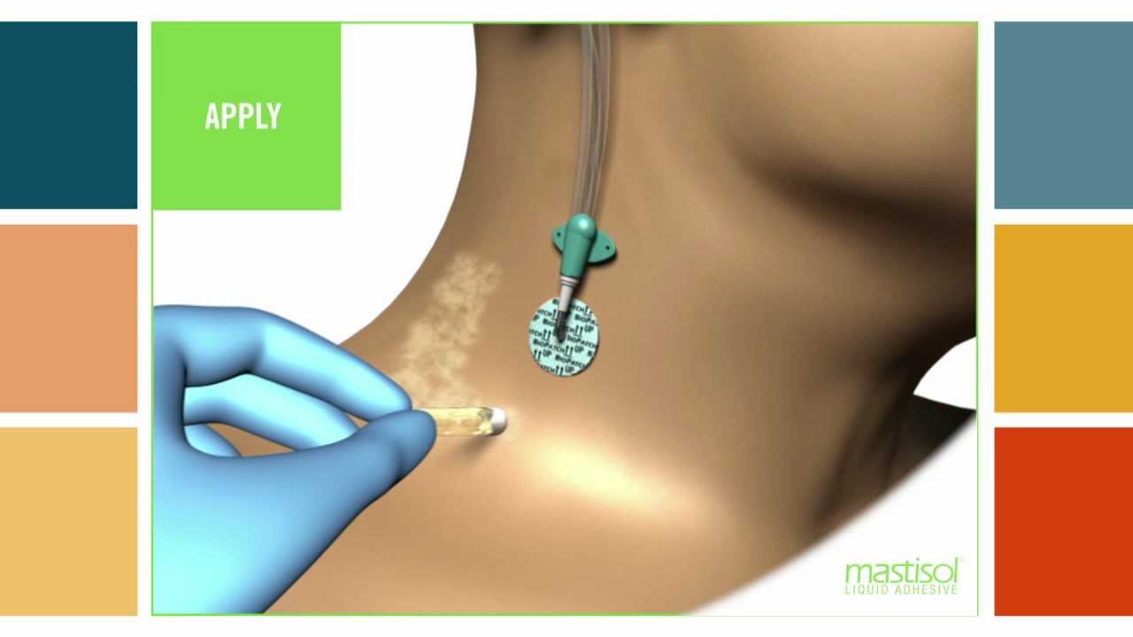 Mastisol® Liquid Adhesive Vial Application Instructions