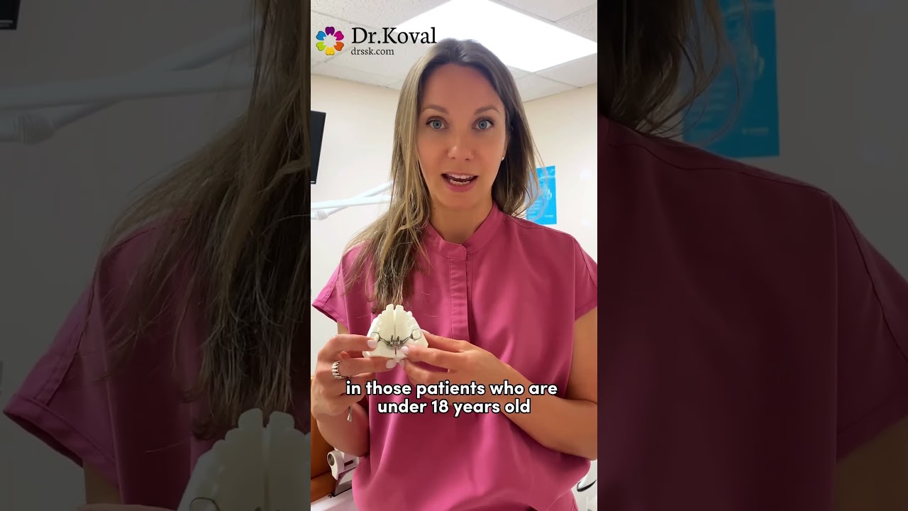 Intro to MSE treatment #mse #marpe #sarpe #airway #orthodontics