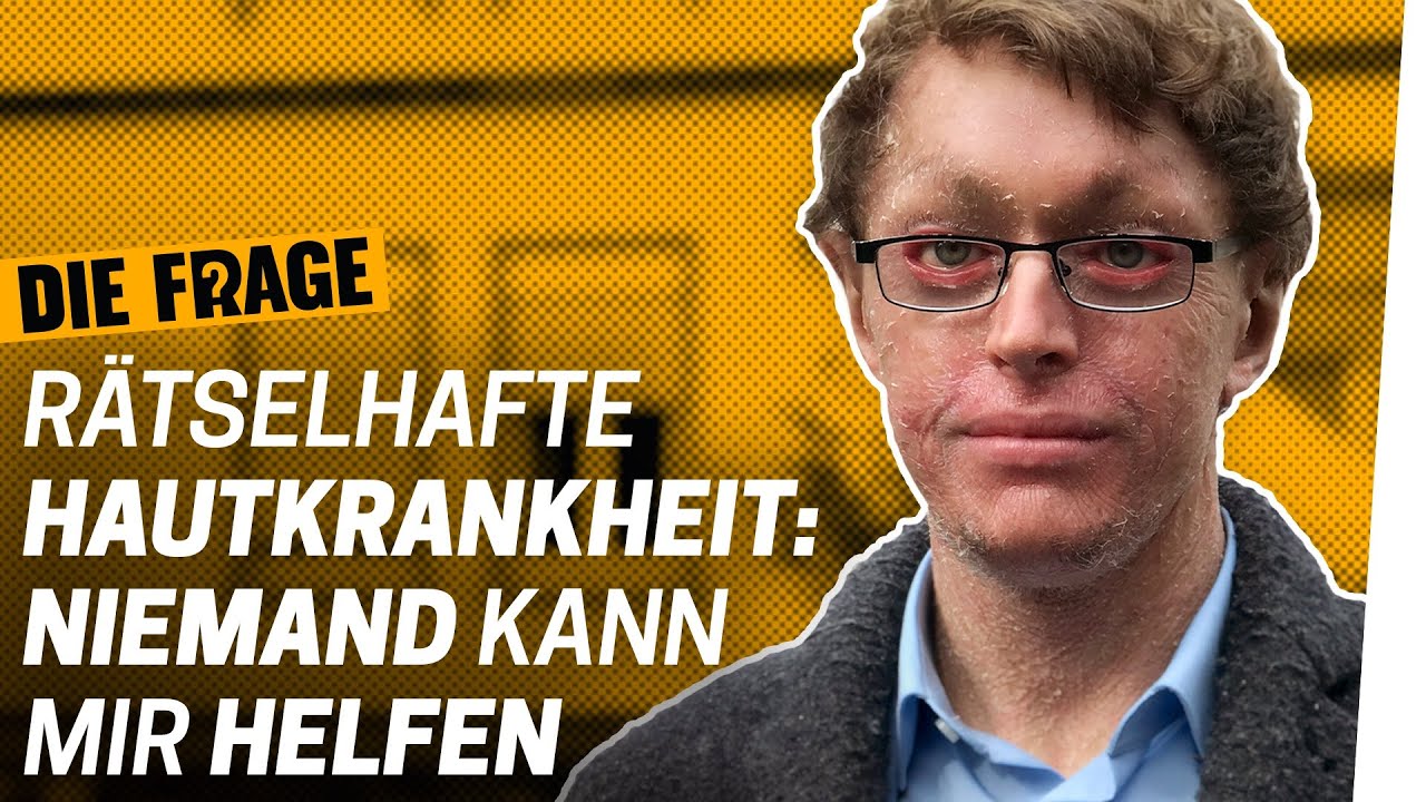 Seltene Krankheit: Mein Leben ohne Heilung | Wie lebe ich mit einer schweren Krankheit? Folge 7