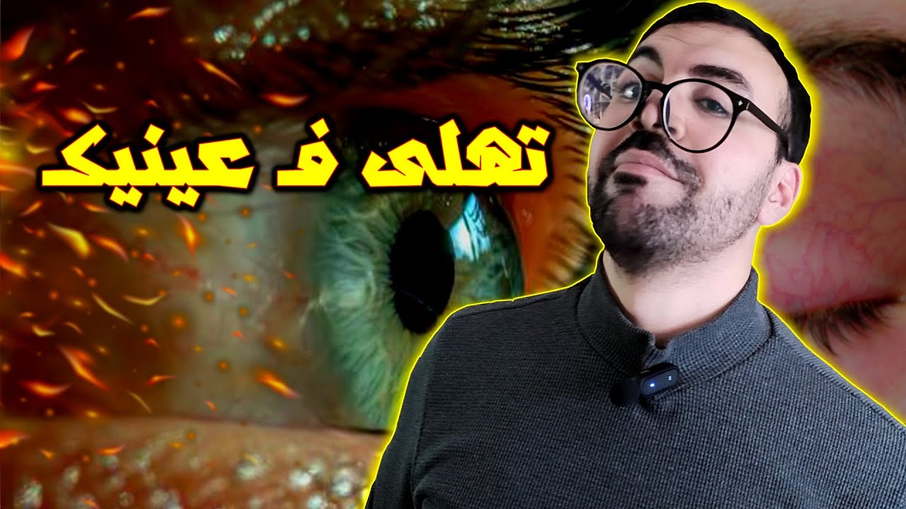 تهلى فـ عينيك - نصائح مهمة
