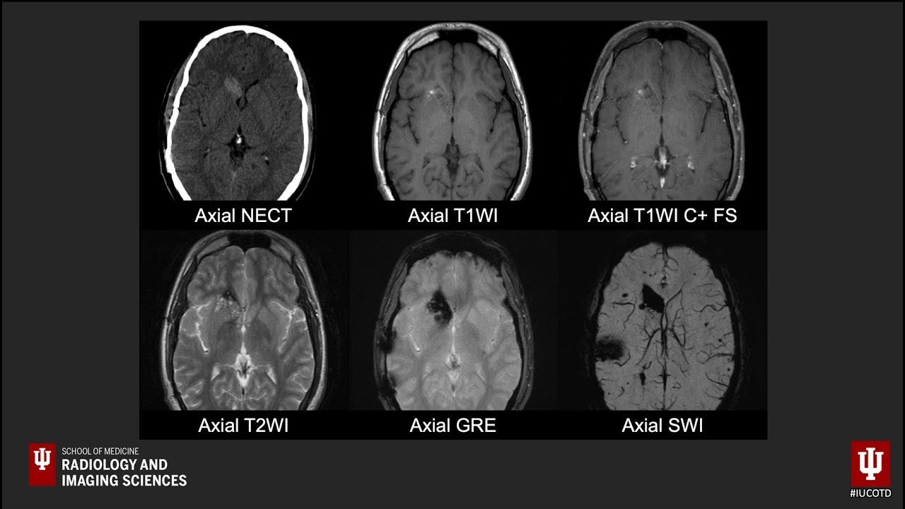 Brain Case of the Day 27