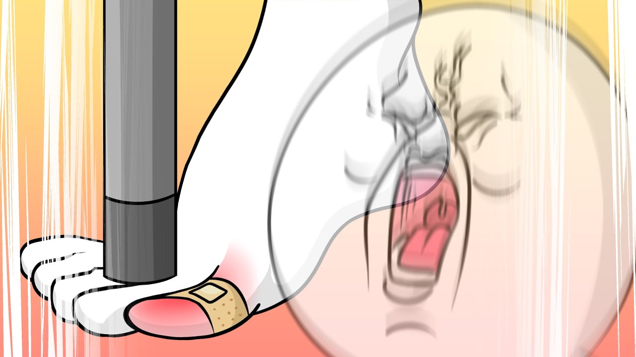 개아파2