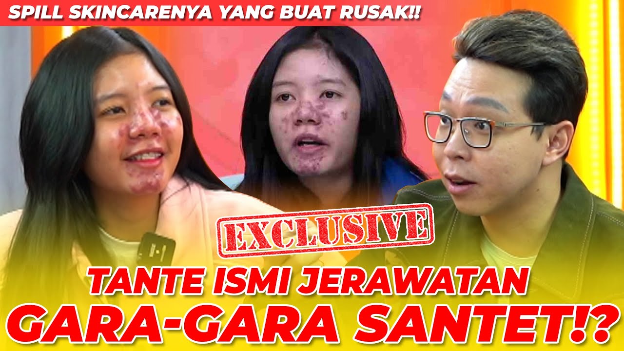 TANTE ISMI JERAWATAN!! GARA-GARA SANTET!? ATAU KARENA SKINCARE INI!? - NGINFUS
