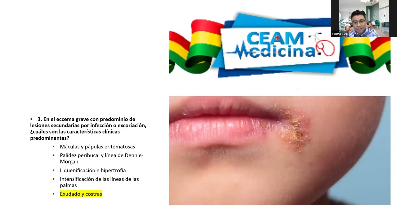 MEDICINA INTERNA TEMAS NUEVOS SOLUCI&Oacute;N BANCO DE PREGUNTAS 2025