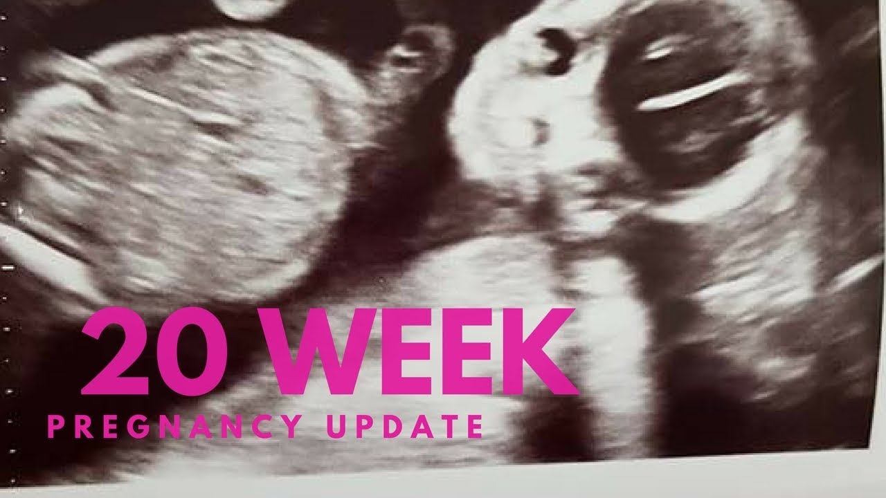 20 Weeks Pregnancy update including hospital spotting scare