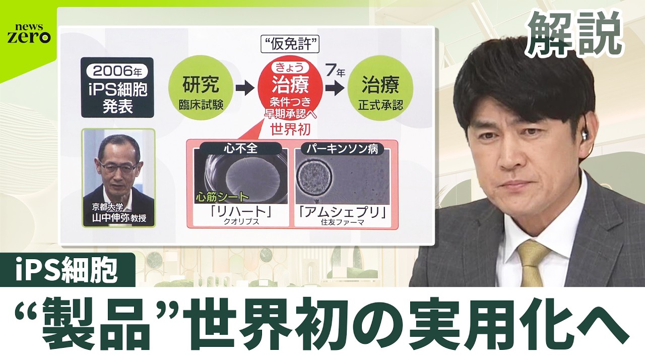 【解説】iPS細胞「早期承認」を了承…今後7年かけ有効性・安全性を確認