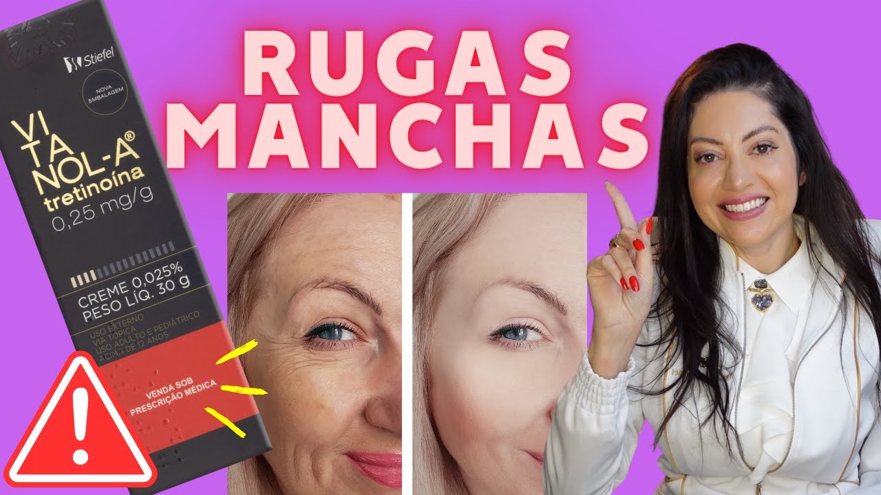 Vitanol-A Vitacid Tretinoína: Clareia Manchas, Reduz Rugas e Combate Acne! Como Usar?
