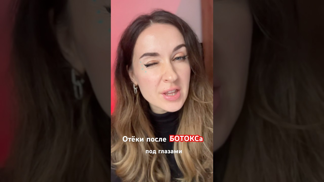 Отеки есть-морщин нет. Ботокс для склонных к отекам. #омоложение #ботокс #морщины #пилинг #красота