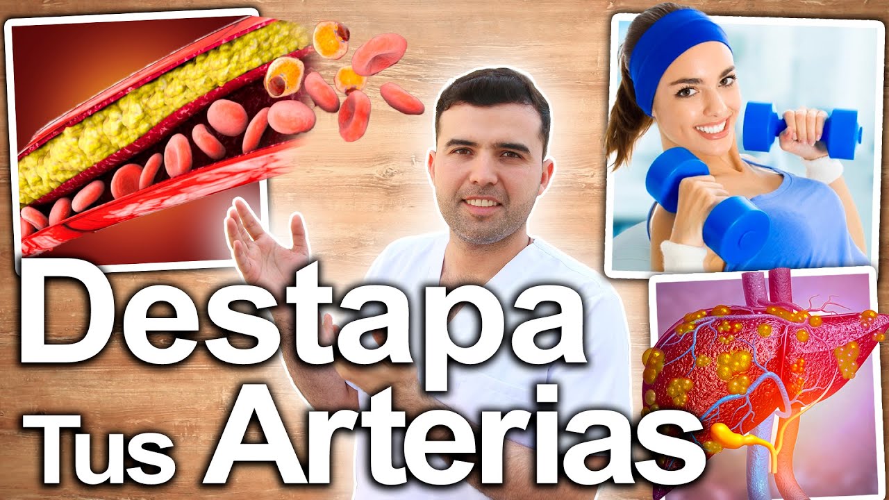 C&Oacute;MO DESTAPAR LAS ARTERIAS - Limpia Y Desobstruye Las Arterias Y Venas 100% Efectivo