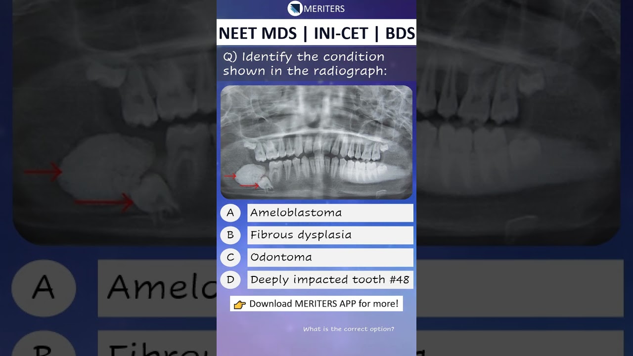 NEET MDS | INI-CET MDS | PSC | BDS - Most Important Questions  #neetmds2025 #mdsprep
