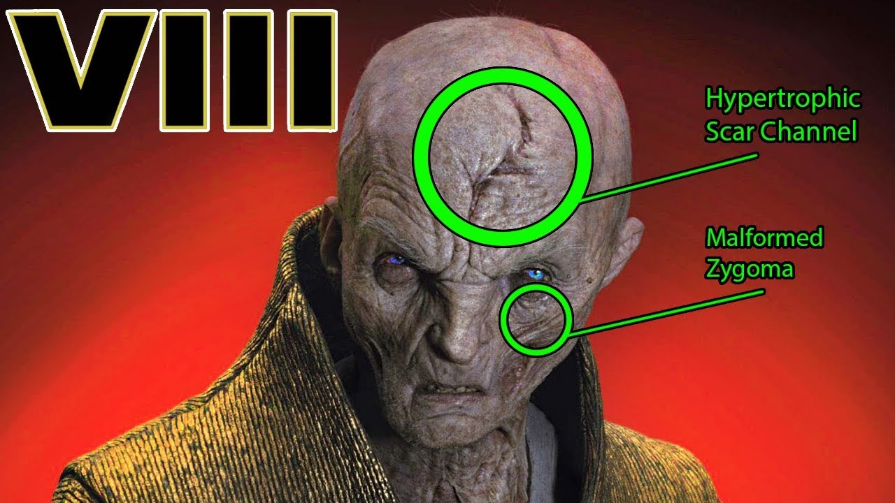 Snoke's INJURIES and SCARS Explained - Star Wars The Last Jedi Explained