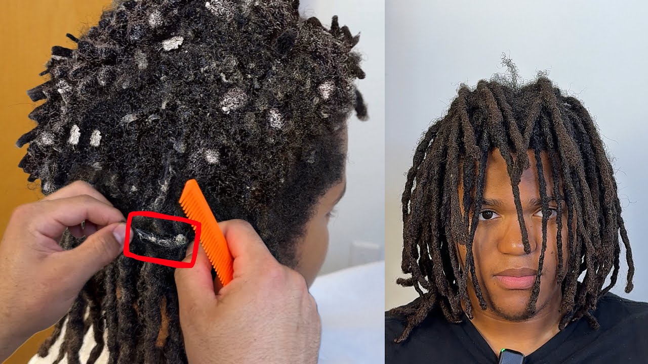 these *CRUNCHY* FLAKES almost BROKE my comb (Watch till the end)