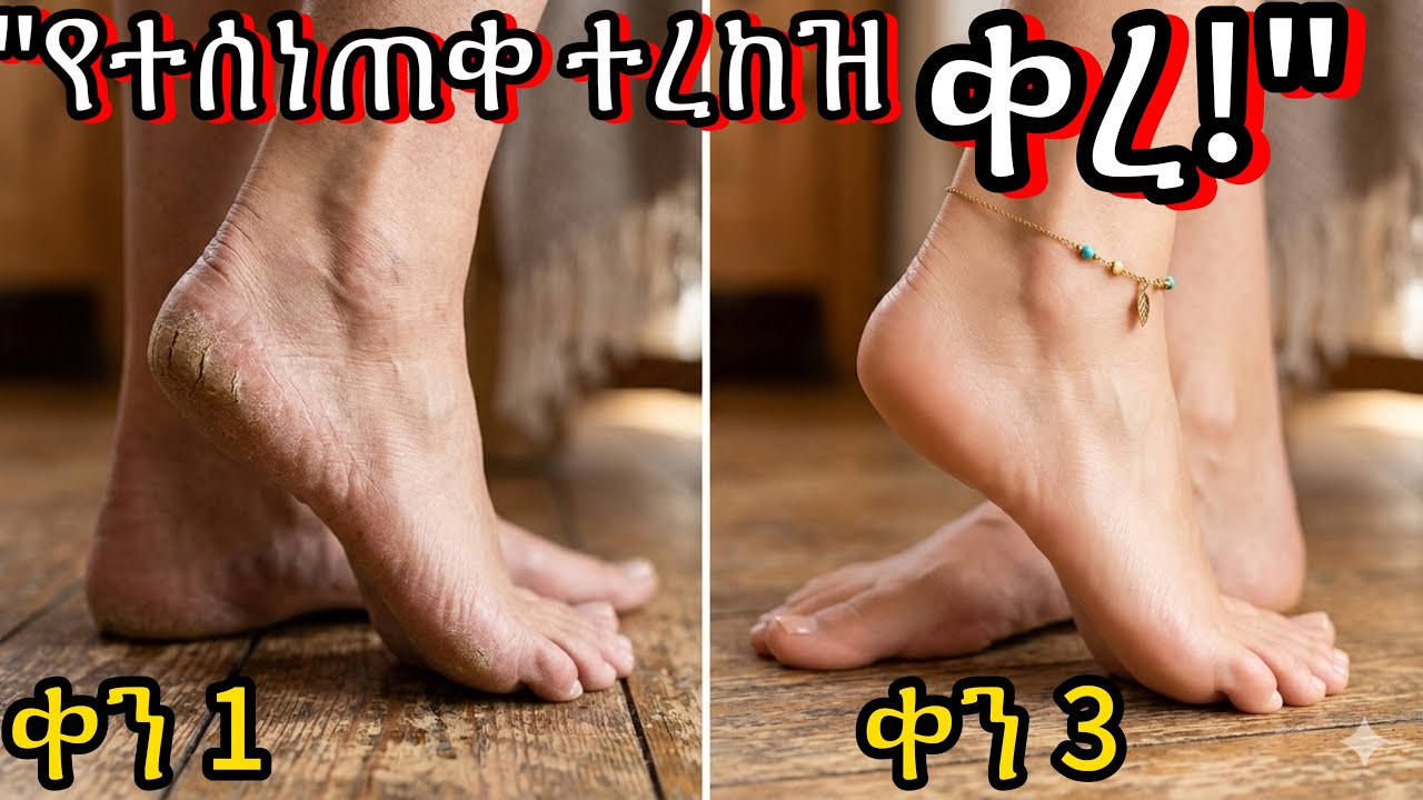 ለስላሳ እና ውብ እግር እንዲኖርዎት ማድረግ ያለብዎት 5 ነገሮች