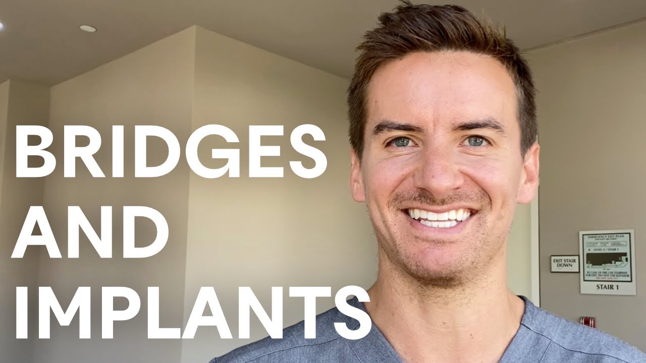The pros and cons of dental bridges and implants