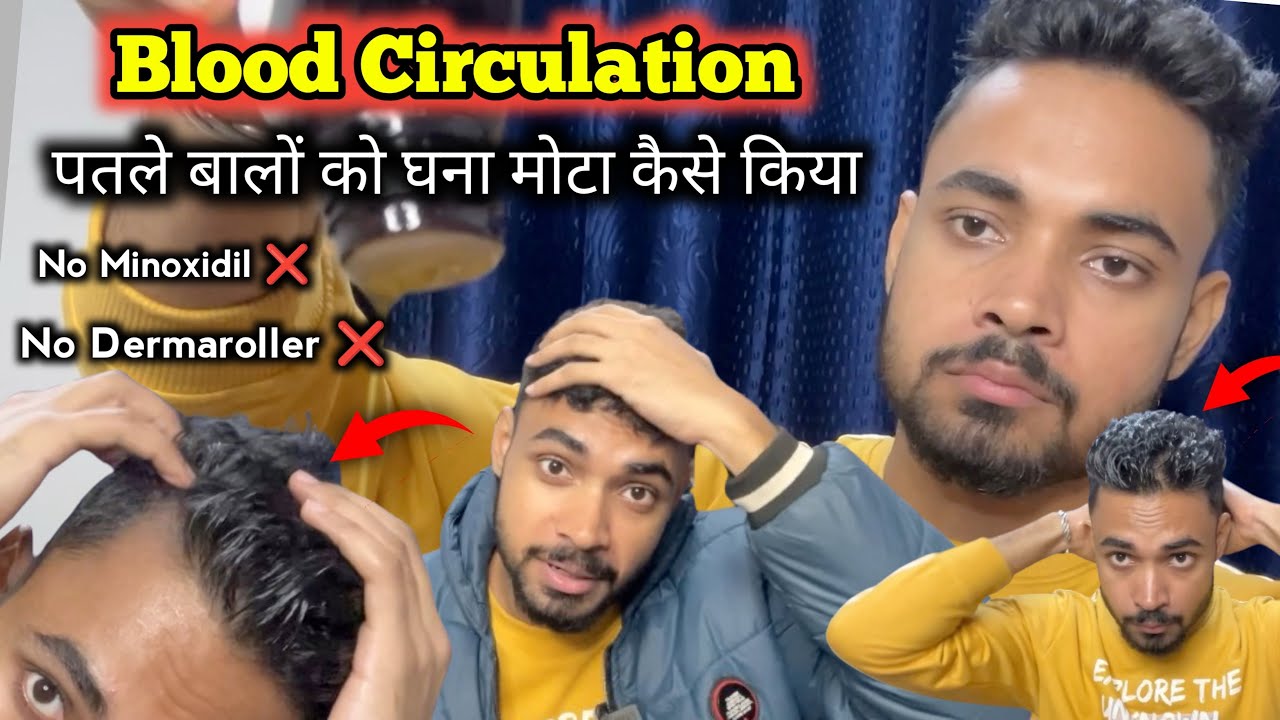 Blood circulation से पतले बालों को घना मोटा कैसे किया | Hair Regrowth For Men Naturally🔥