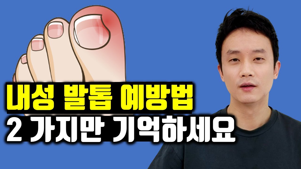 내성 발톱 ! 스스로 예방 & 치료하는 두 가지 방법