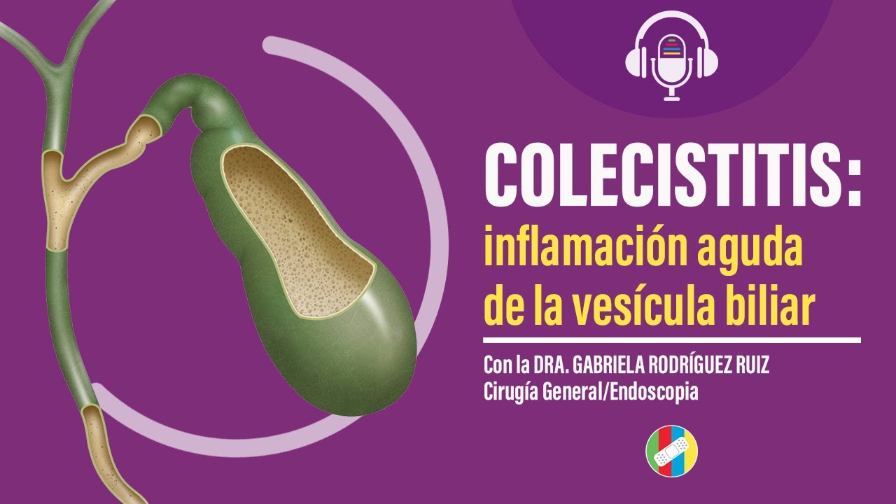 Colecistitis  inflamaci&oacute;n aguda de la ves&iacute;cula biliar.