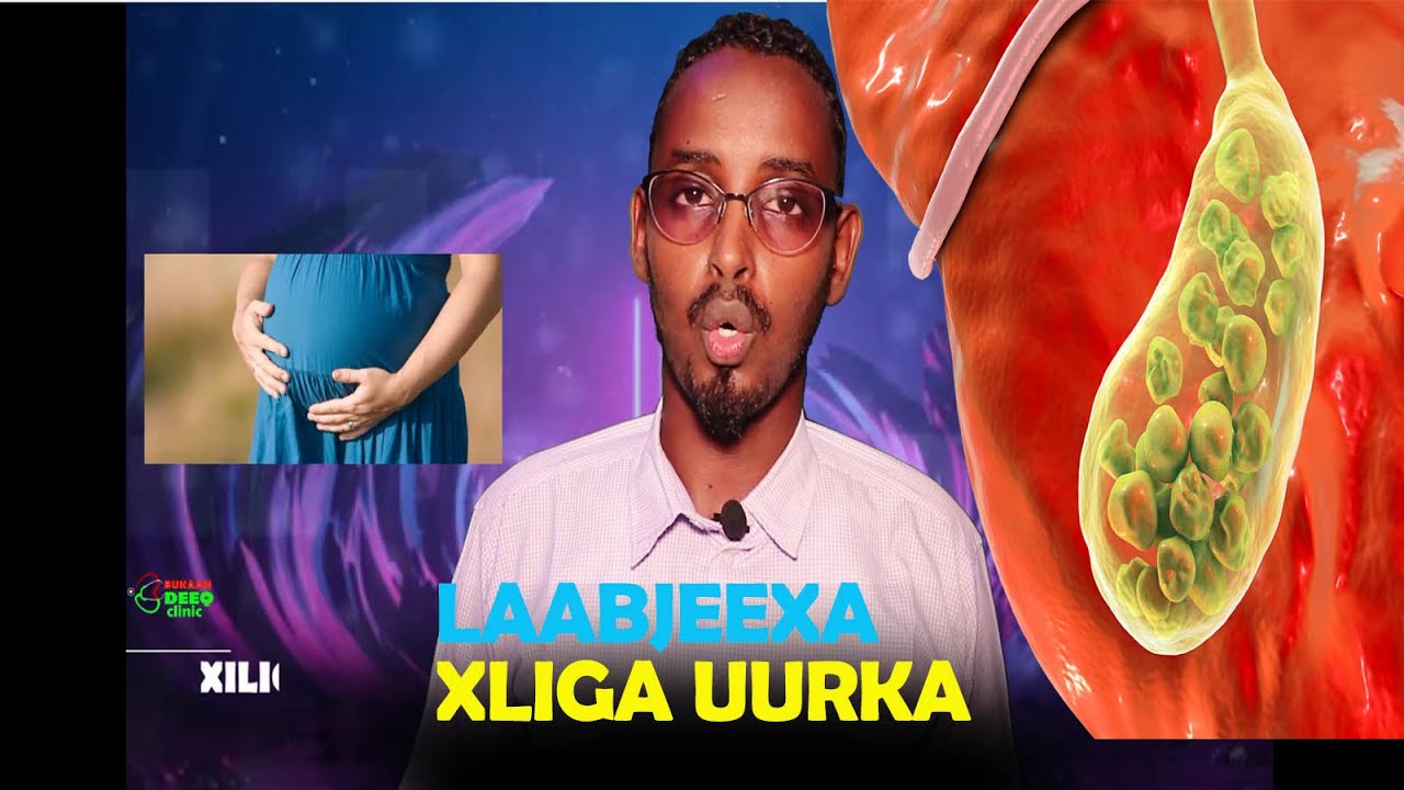 LAABJEEXA IYO BOG XANUUNKA XILIGA UURKA (GERD)