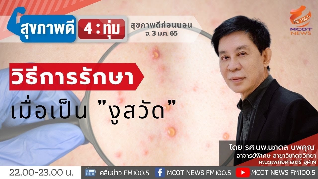 วิธีการรักษาเมื่อเป็น "งูสวัด"