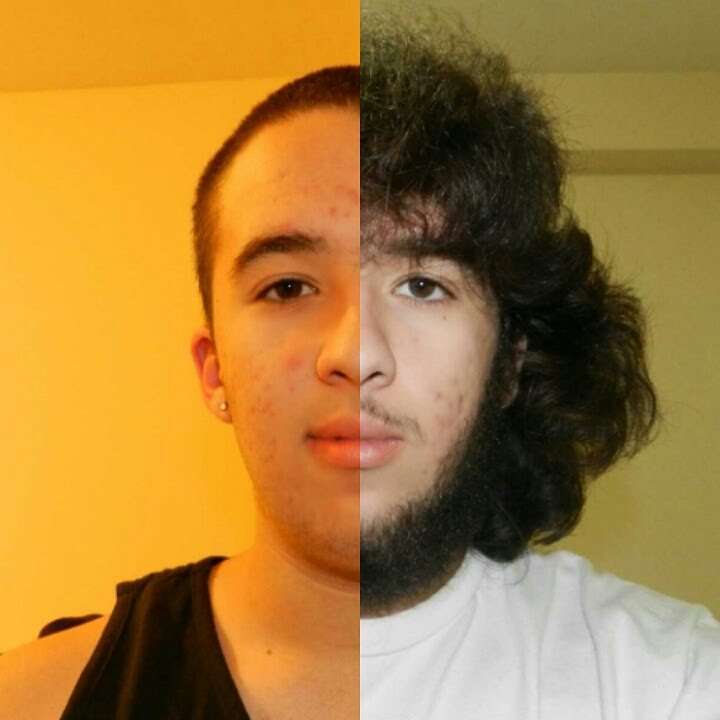 1 Year Hair Growth Time Lapse