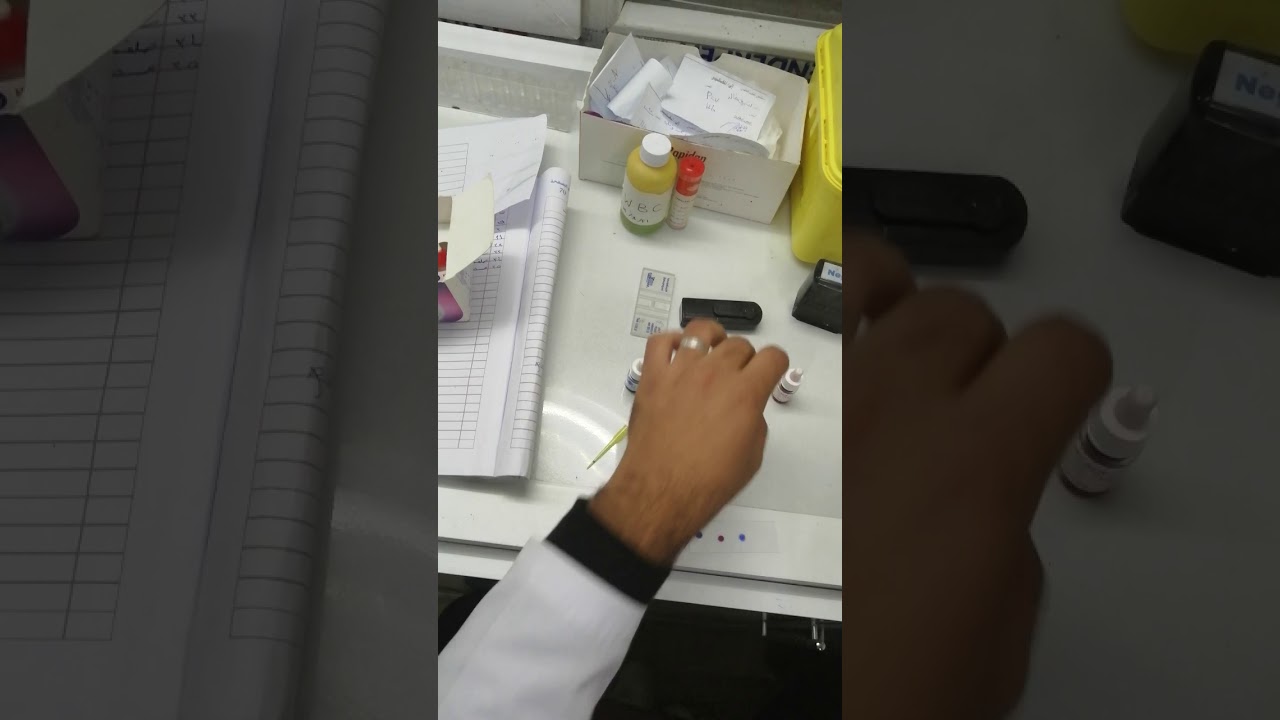 فحص التايفوئيد ،  widal test