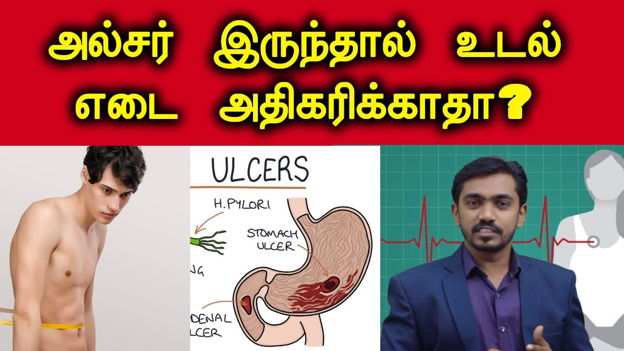 ரொம்ப ஒல்லியாவே இருக்கிங்களா? அப்பொ இந்த விடியோ உங்களுக்குதான்  UNDER WEIGHT DUE TO ULCER? | DrSJ