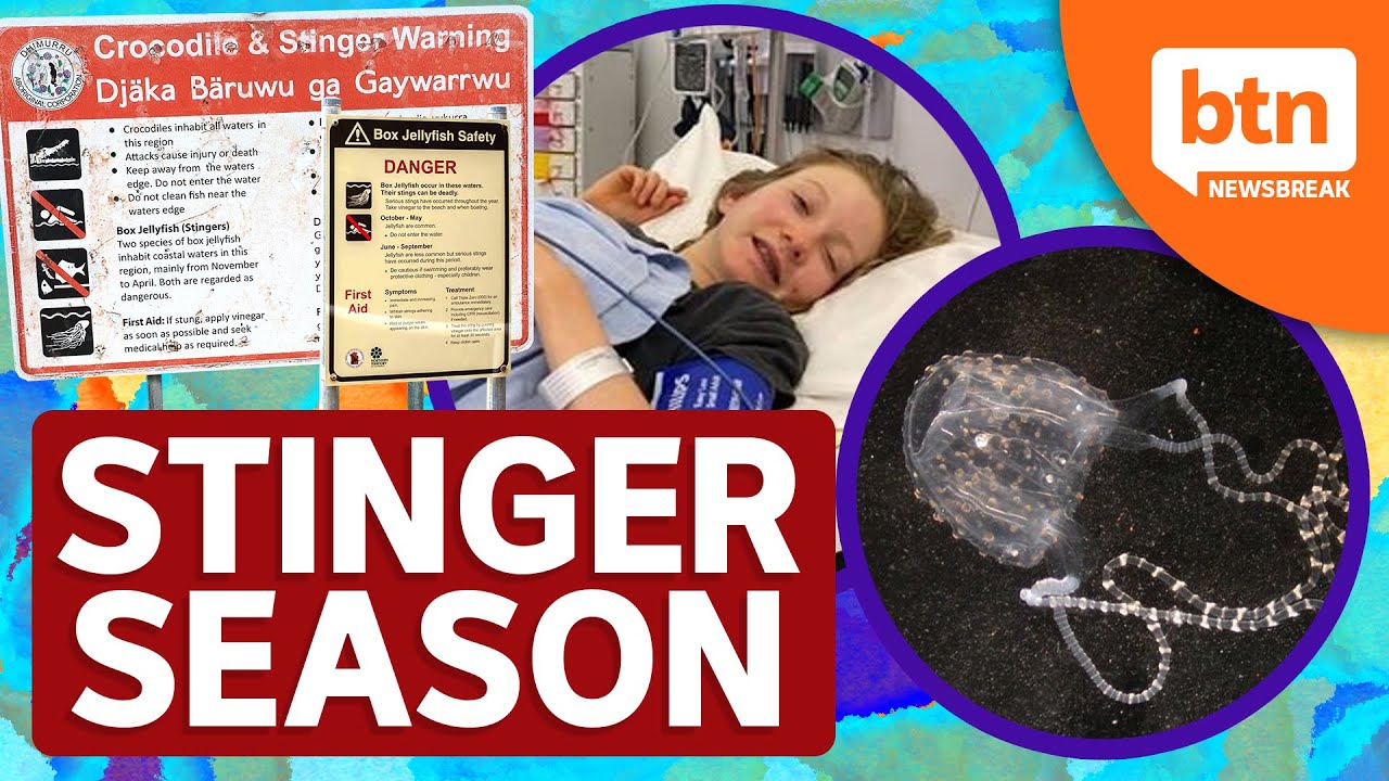 Stinger Season Begins as NT Teenager Survives Irukandji Jellyfish Sting