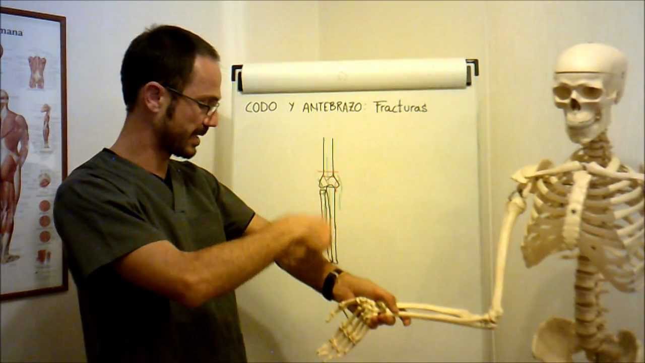 umh1729 2012-13 Lec007 Fracturas codo y antebrazo