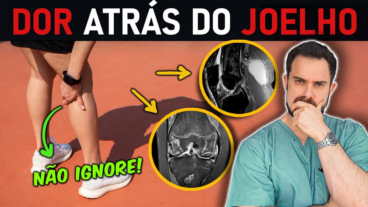 Dor Atrás do Joelho: GUIA COMPLETO! As 9 Principais Causas e como TRATAR (Aulão C/ ESPECIALISTA)