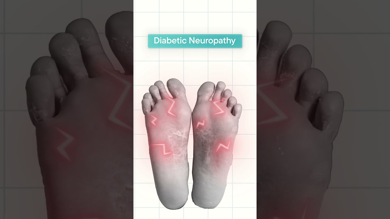 Can Cannabis Really Help Nerve Pain?