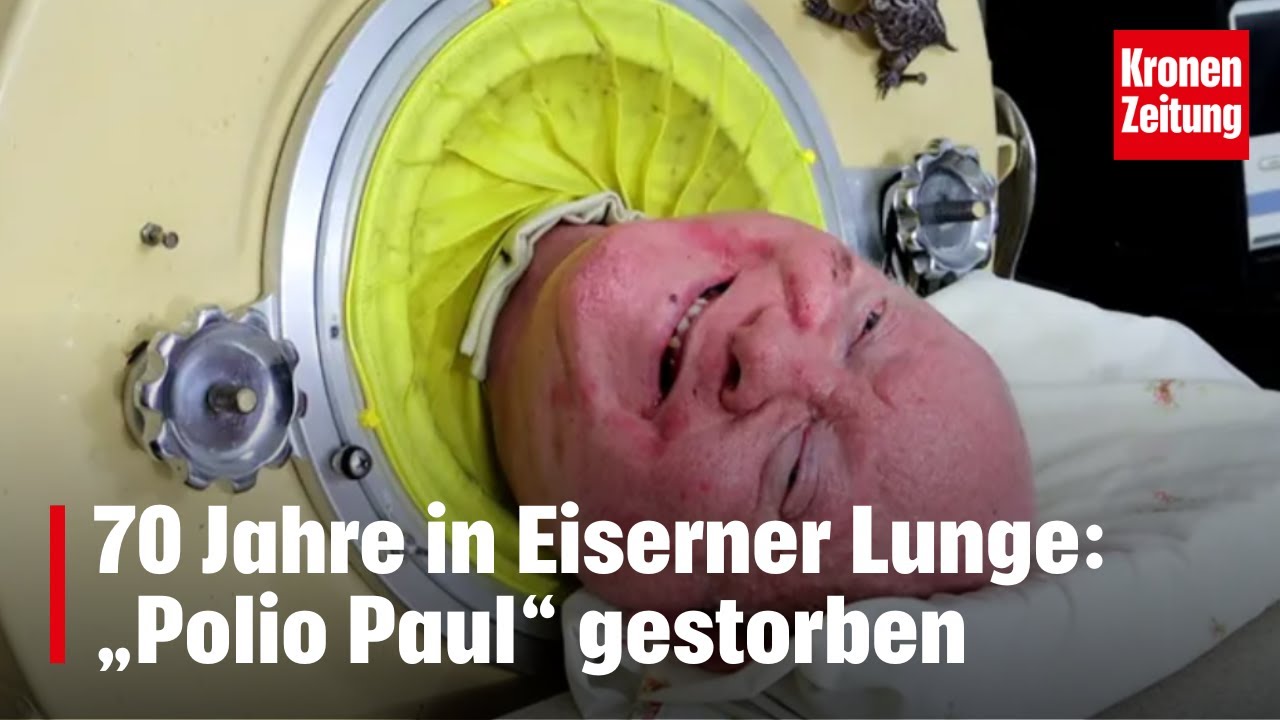 70 Jahre in Eiserner Lunge: &bdquo;Polio Paul&ldquo; gestorben | krone.tv NEWS