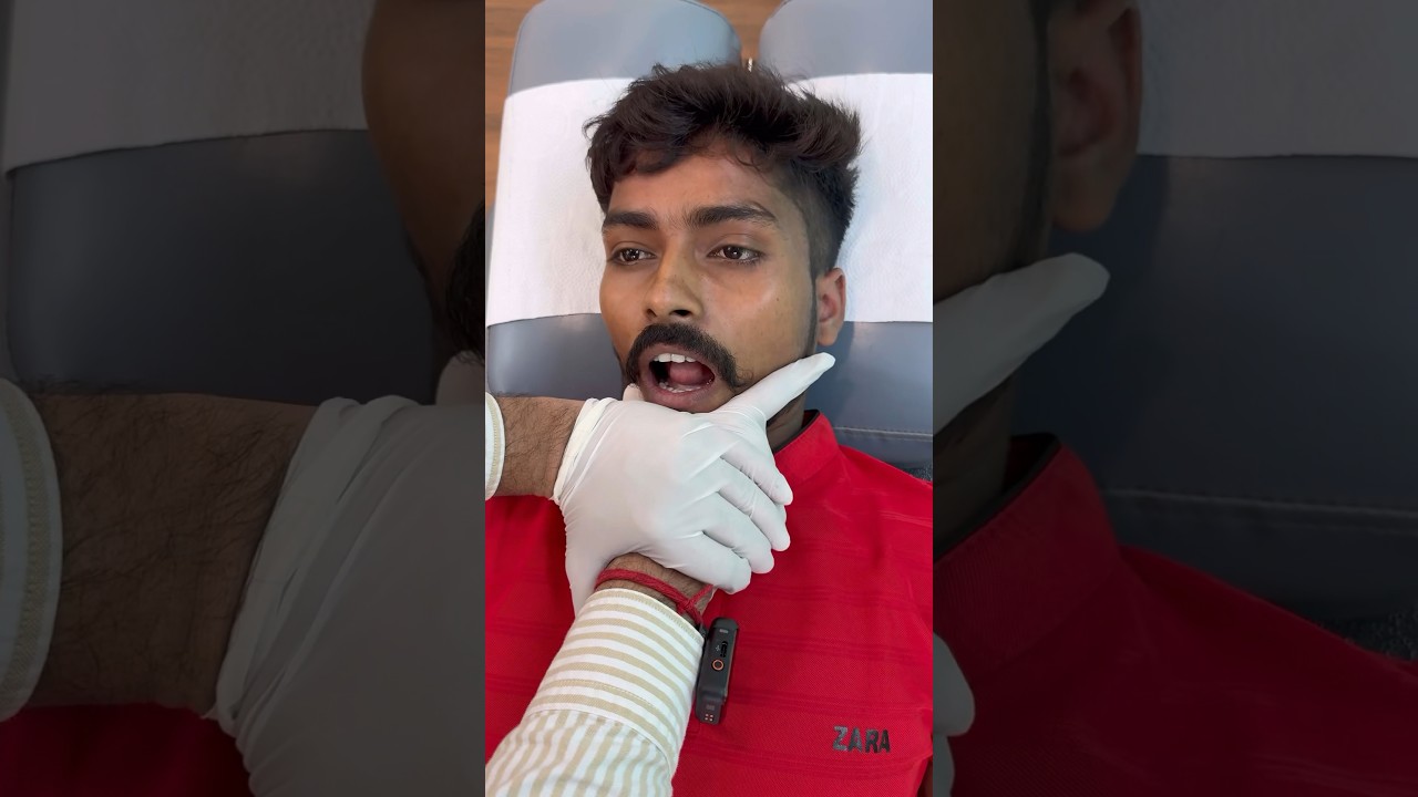 Tmj jaw dislocation treatment #trend #feed #ytshort #tmjtreatment