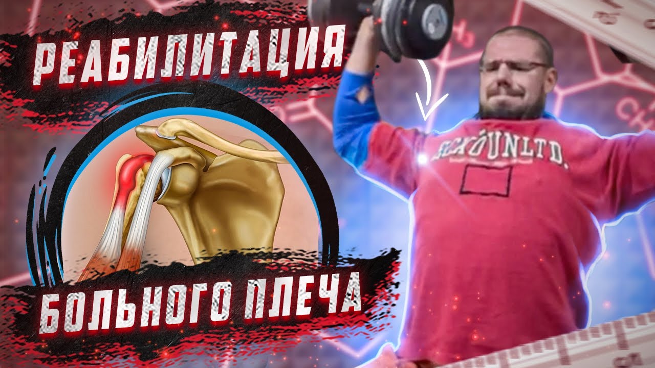 Как я травмировал и восстановил плечо | Тендинит длинной головки бицепса
