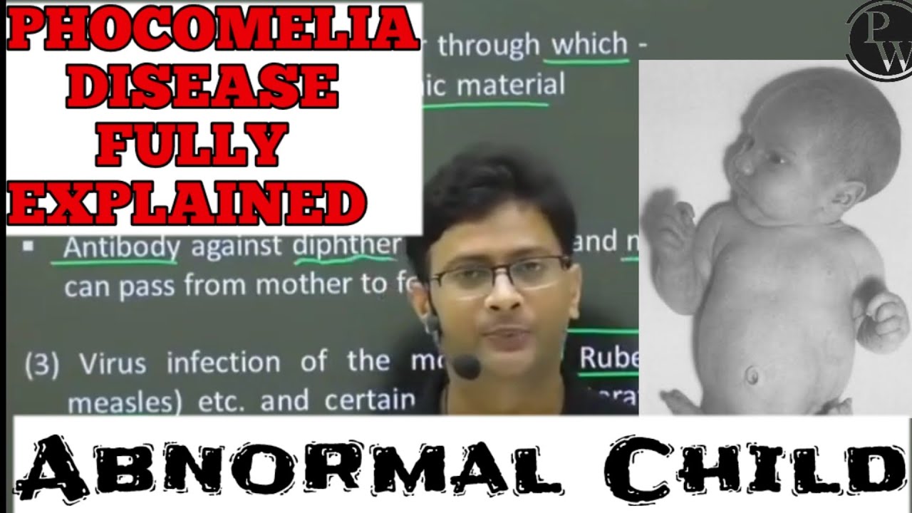 #physicswallah - Phocomelia fully explained by Manish Dubey sir || Misuse of drugs