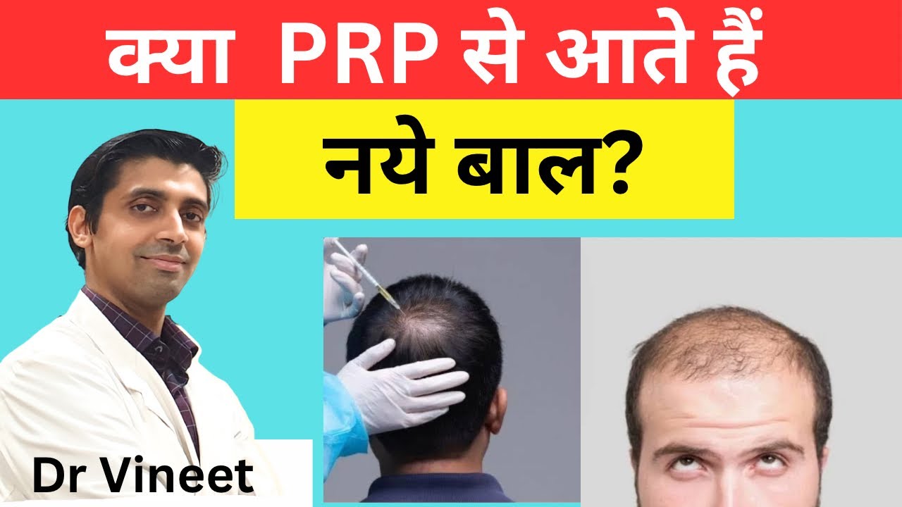 क्या PRP से आ सकते हैं नए बाल? VR Skin Clinic | Bikaner