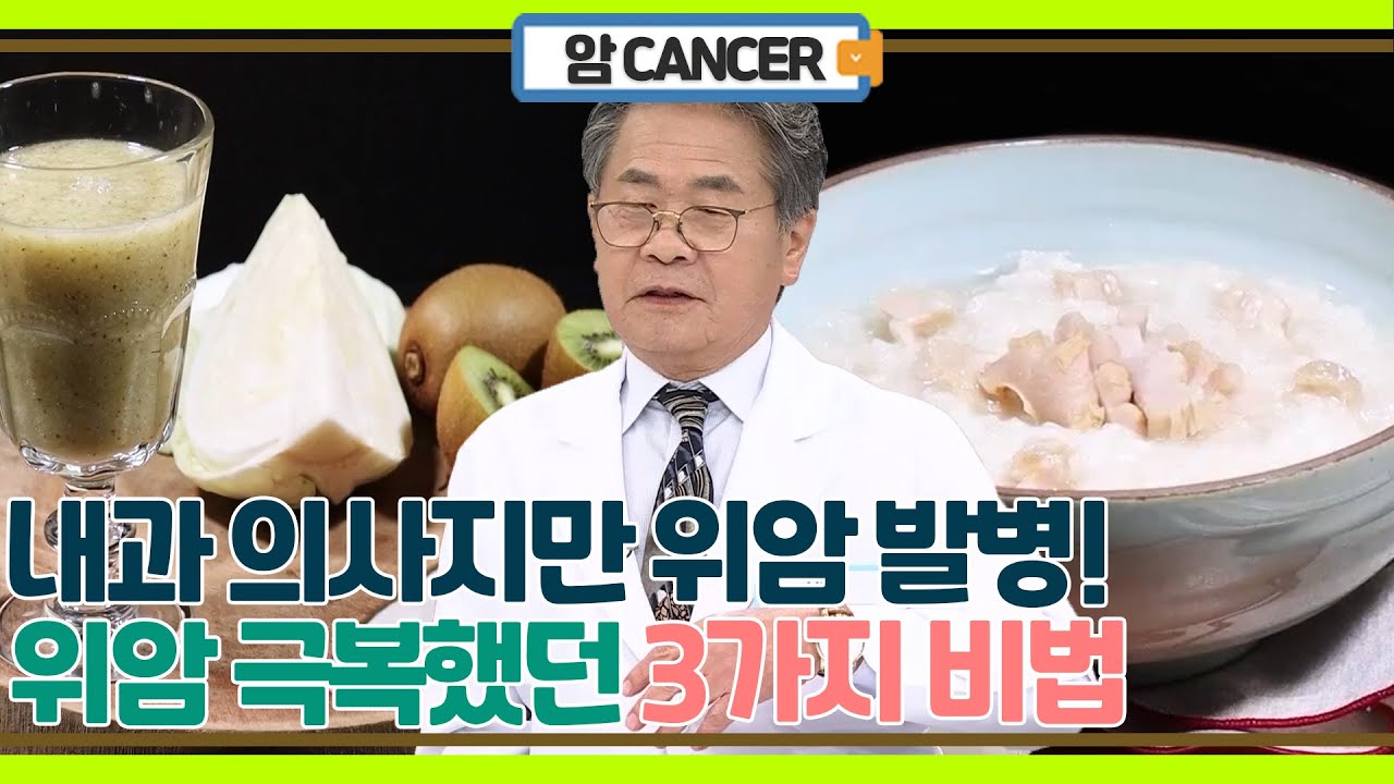 내과 의사도 못 피한 위암! 위의 80% 절제 후 딱 3가지 방법으로 위암 완치!
