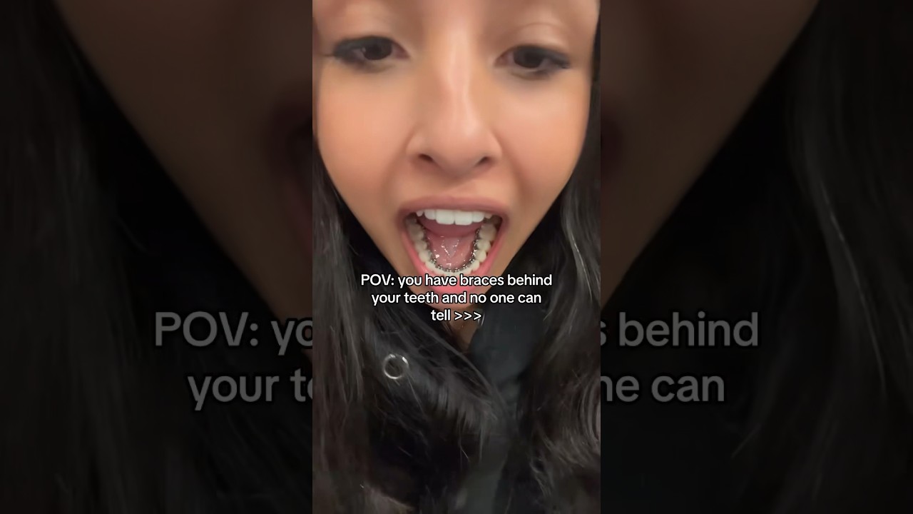 You Would NEVER Know She Had These In Her Mouth! 🤫🦷