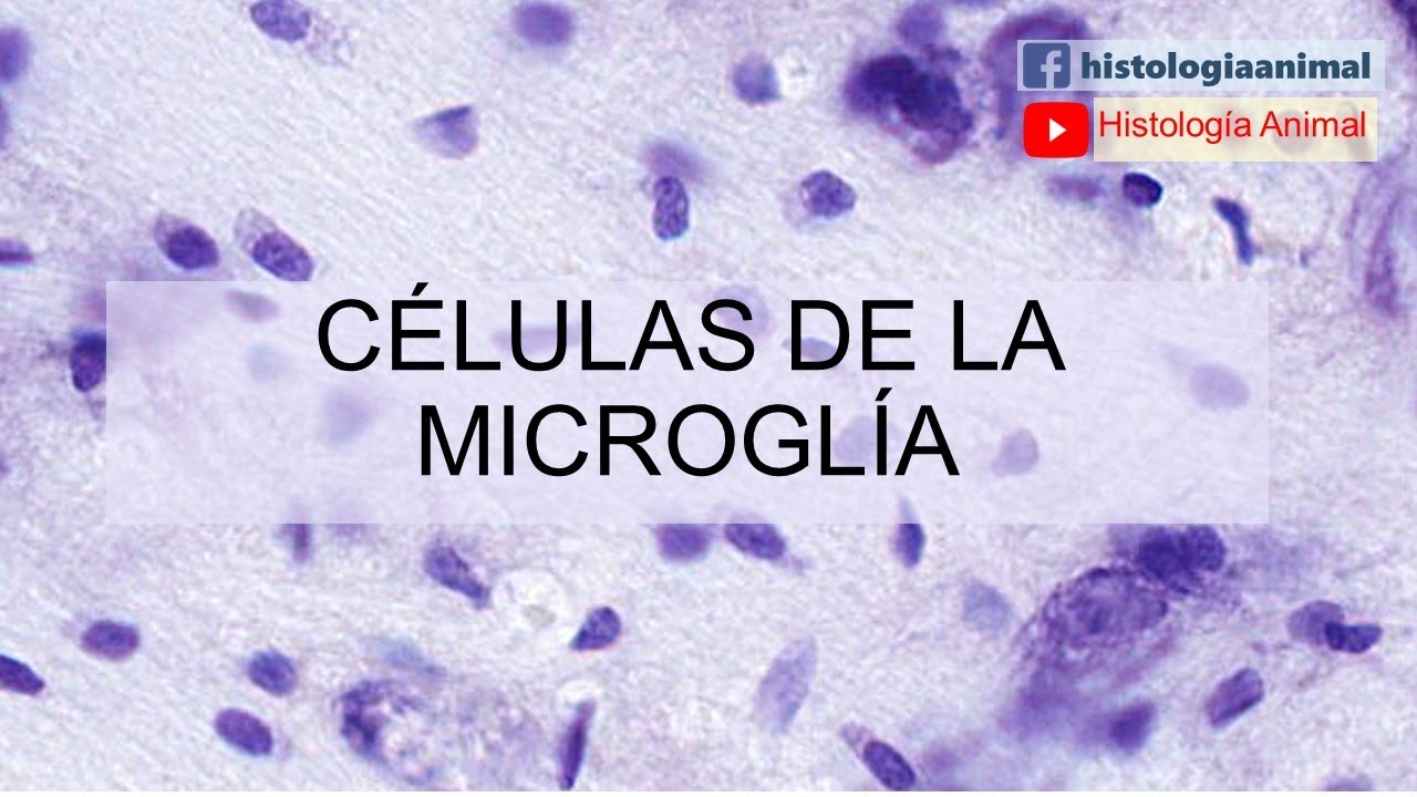 Células de la microglía  - Tejidos Básicos - Curso en Línea 2-032