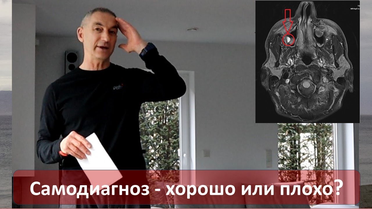 Самодиагноз по снимкам МРТ - приводит только к панике.
