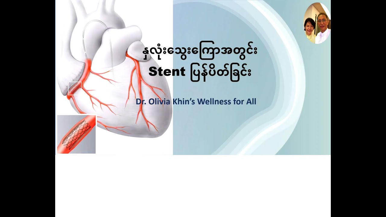 နှလုံးသွေးကြောအတွင်း Stent ပြန်ပိတ်ခြင်း (Stent Restenosis)