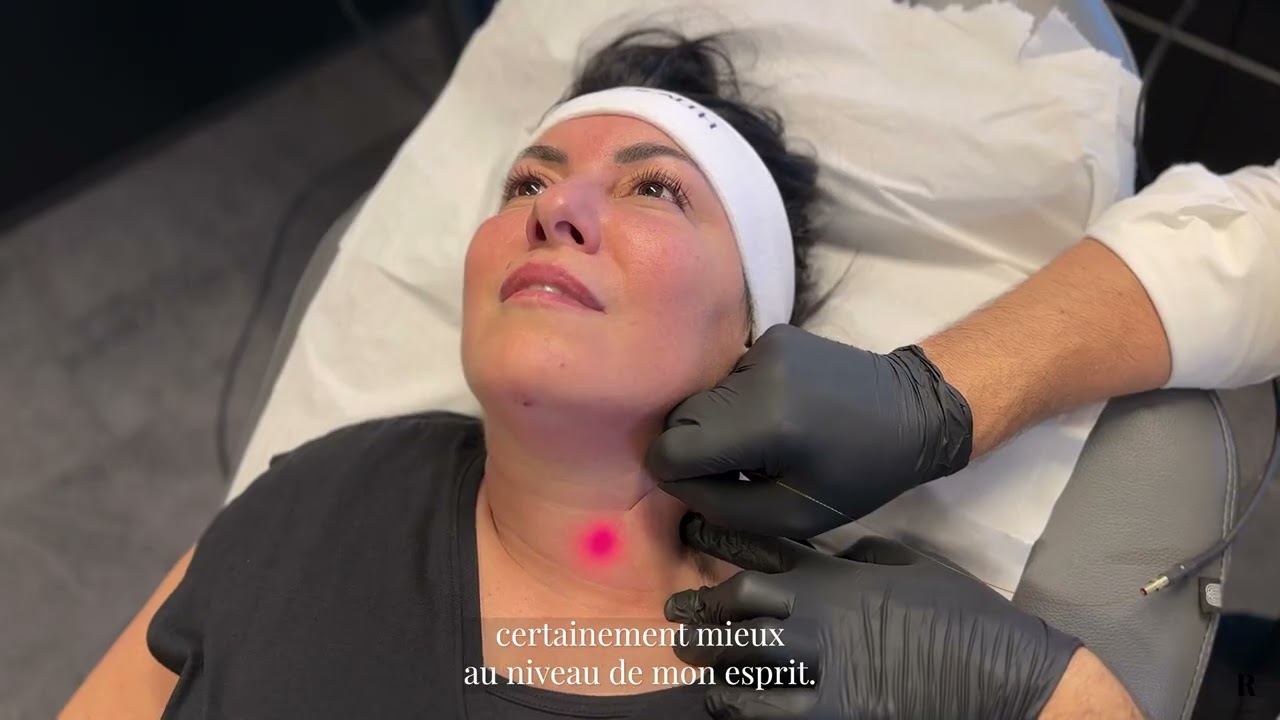 Témoignage de Myriam sur l'Endolift - Patiente chez Clinic Renaissance