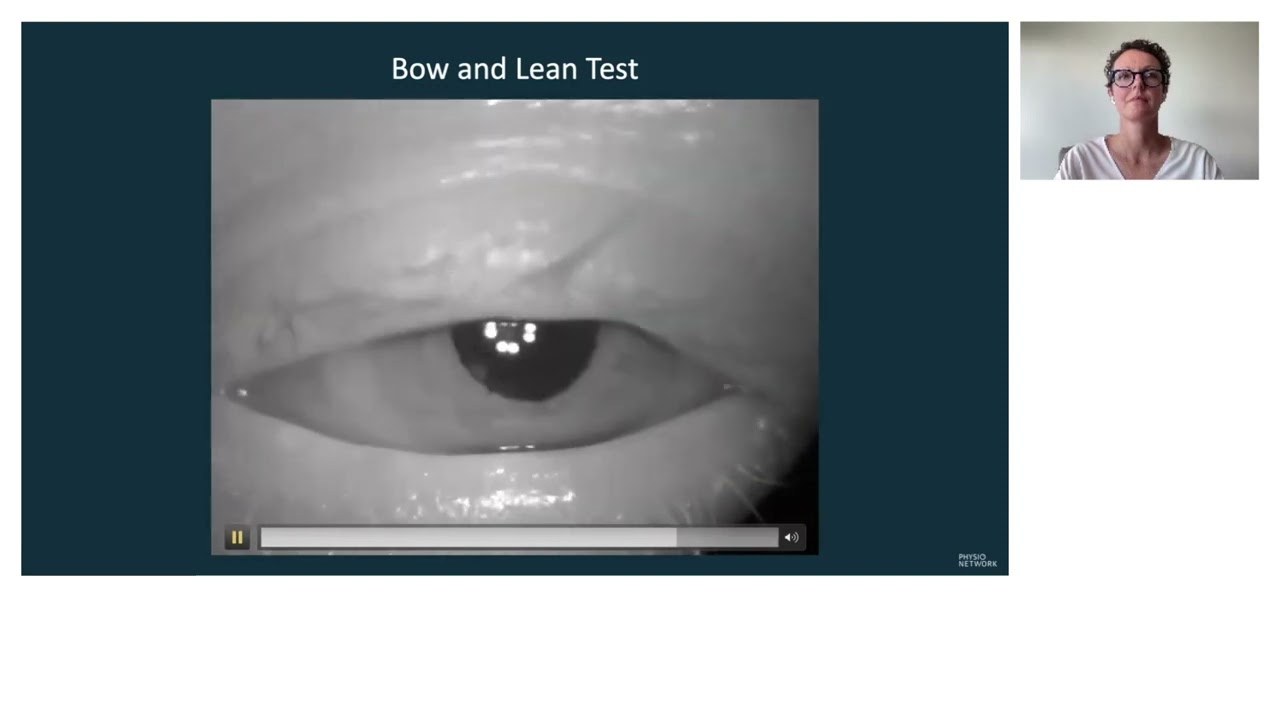BPPV Bow and Lean Test | Vanessa Simpson | BPPV Case Study
