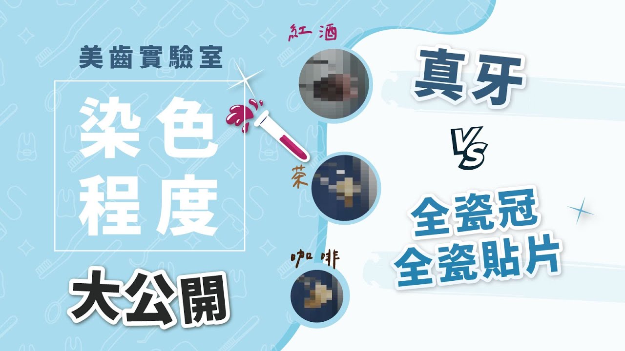 我把牙齒泡在紅酒三個禮拜！發現它竟然...｜美齒實驗室ep.1：真牙vs全瓷冠全瓷貼片染色程度