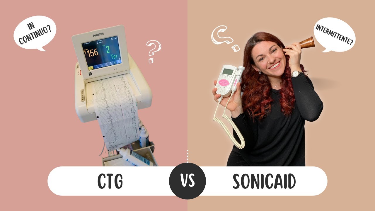 Monitoraggio fetale in travaglio: tracciato cardiotocografico (CTG) o auscultazione a intermittenza?