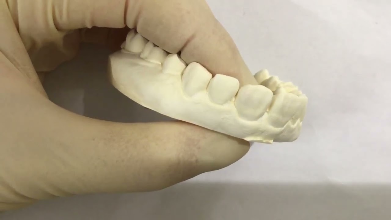 ホームホワイトニング　作り方