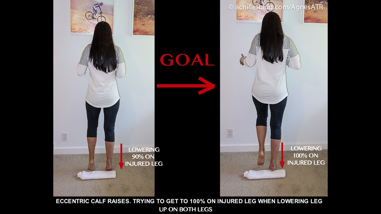 #7 WEEK 12-13 - Achilles Tendon Rupture (ATR) - Non Surgical Treatment