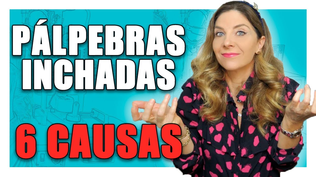 P&aacute;lpebras Inchadas - 6 Causas de P&aacute;lpebras Inchadas