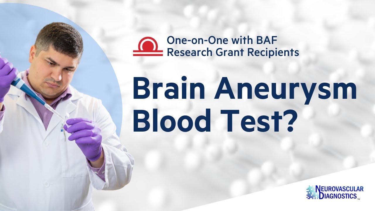 Diagnosing Brain Aneurysms with a Simple Blood Test | Vincent Tutino