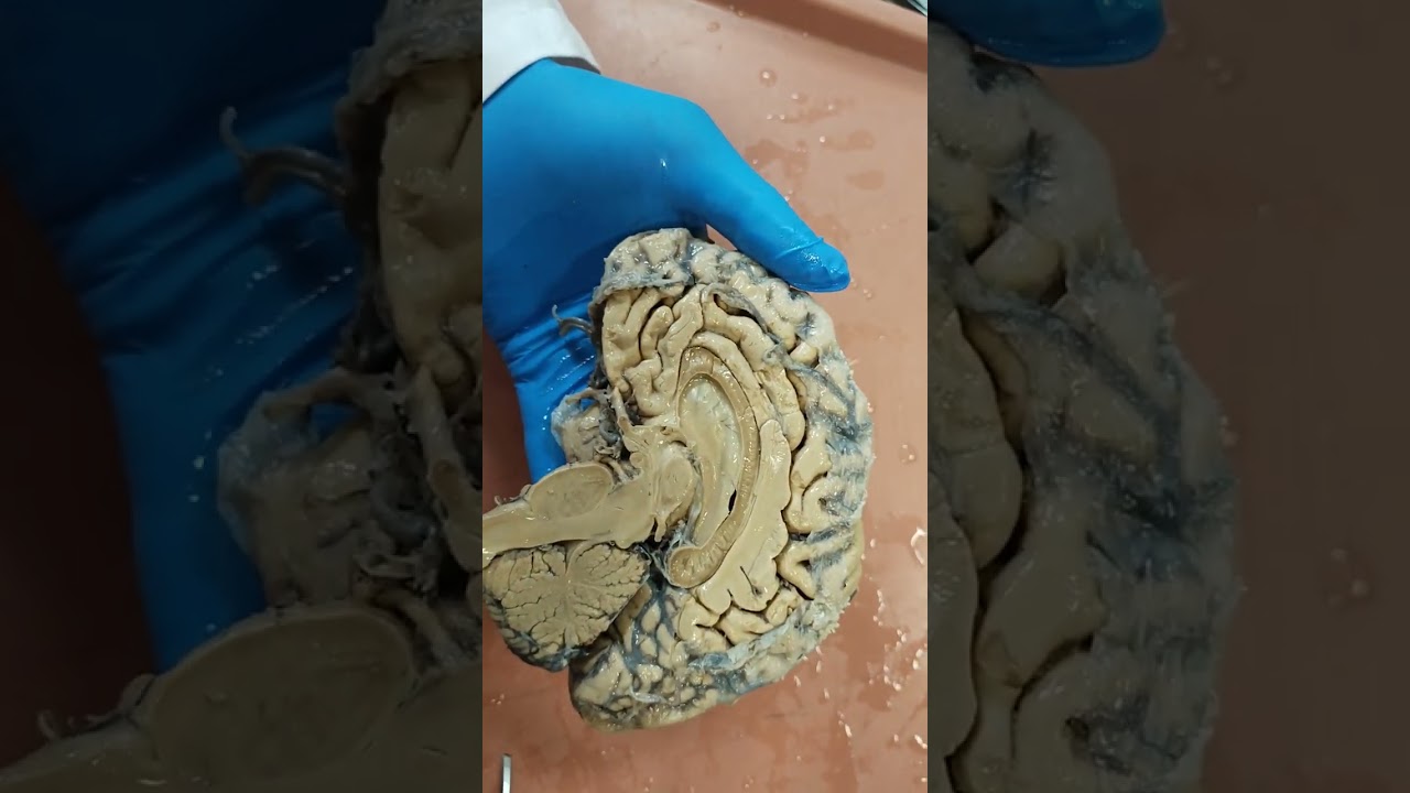 Sistema límbico: neuroanatomía macroscópica.