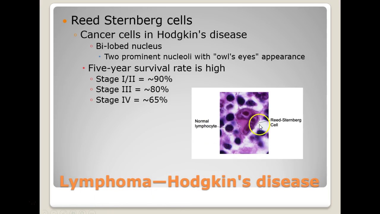 Immunoproliferative diseases and tumor markers.